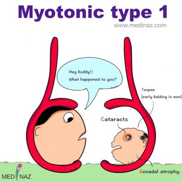 Myotonic Dystrophy Type 1 Mnemonic Medinaz Blog