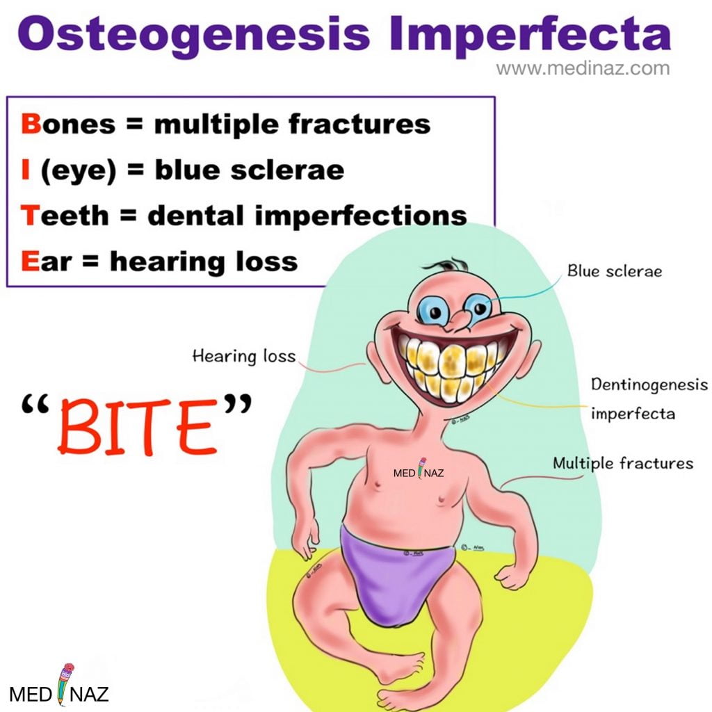 osteogenesis imperfecta mnemonic