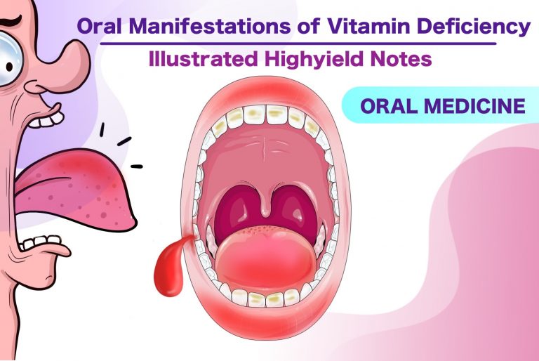 Oral manifestations of Vitamin Deficiency High yield notes Medinaz Blog