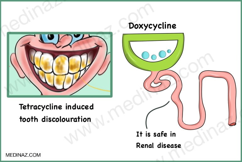 Tooth discolouration