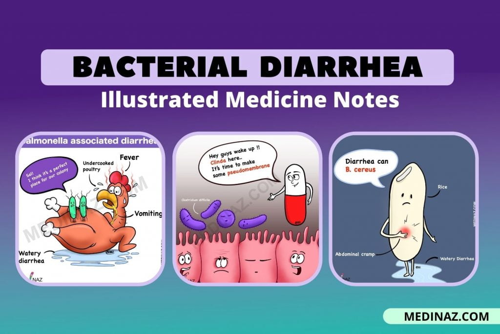 Bacterial causes of diarrhea - Illustrated Medicine Notes - Medinaz Blog