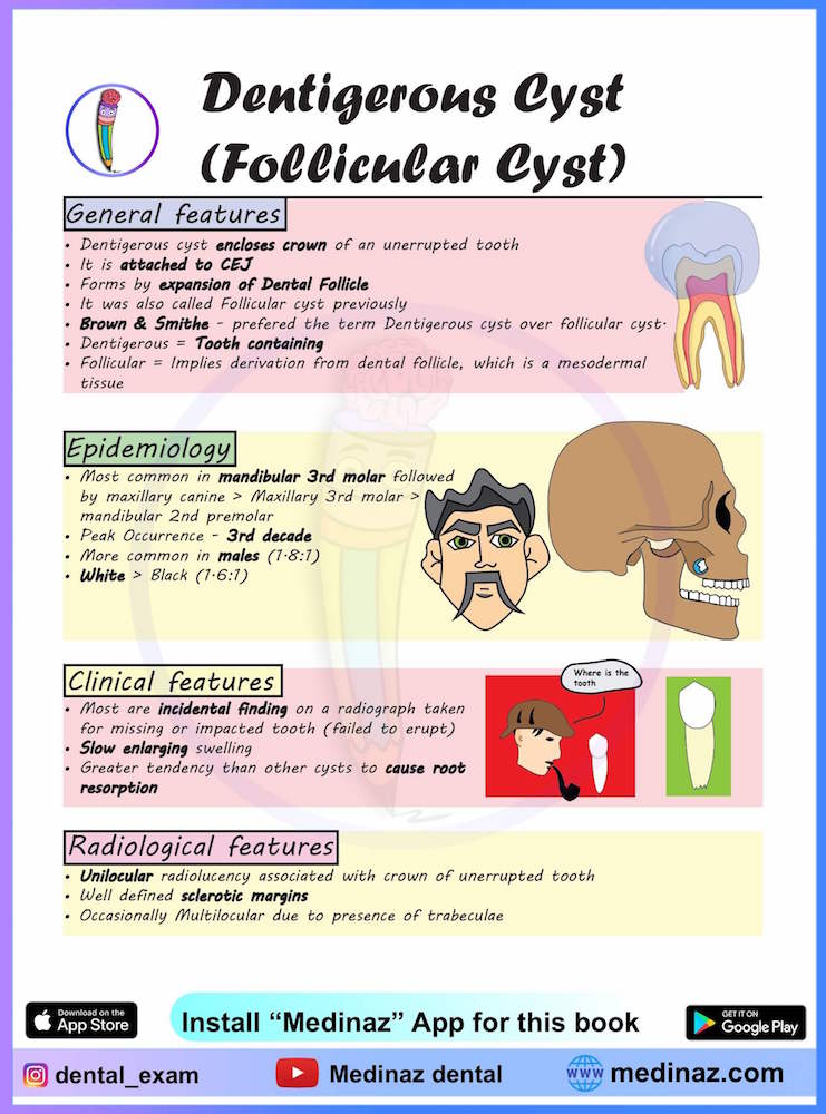 Dentigerous Cyst Oral Pathology Notes - Medinaz Blog