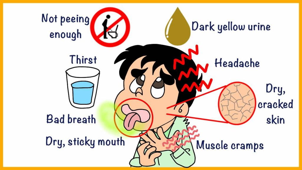 Dehydration signs and symptoms