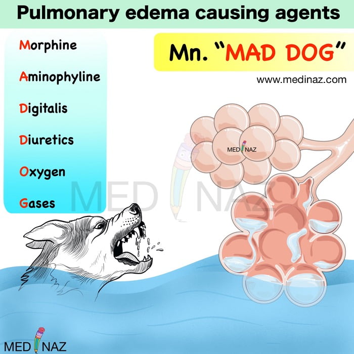 Pulmonary edema causing agents mnemonic