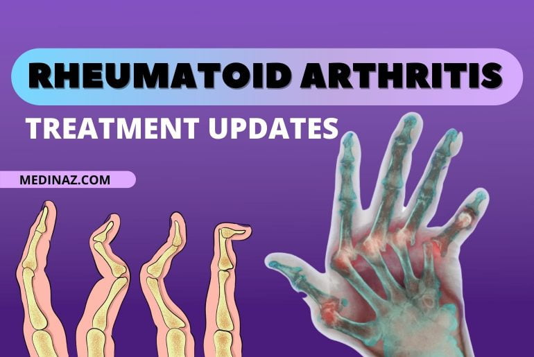 Rheumatoid arthritis treatment