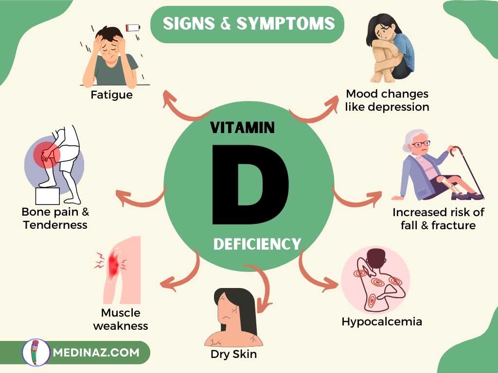 Vitamin D Deficiency Sources Daily Requirements Benefits Treatment 4813