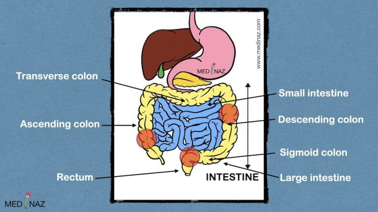 Colon Cancer Symptoms and Warning Signs - Medinaz Blog