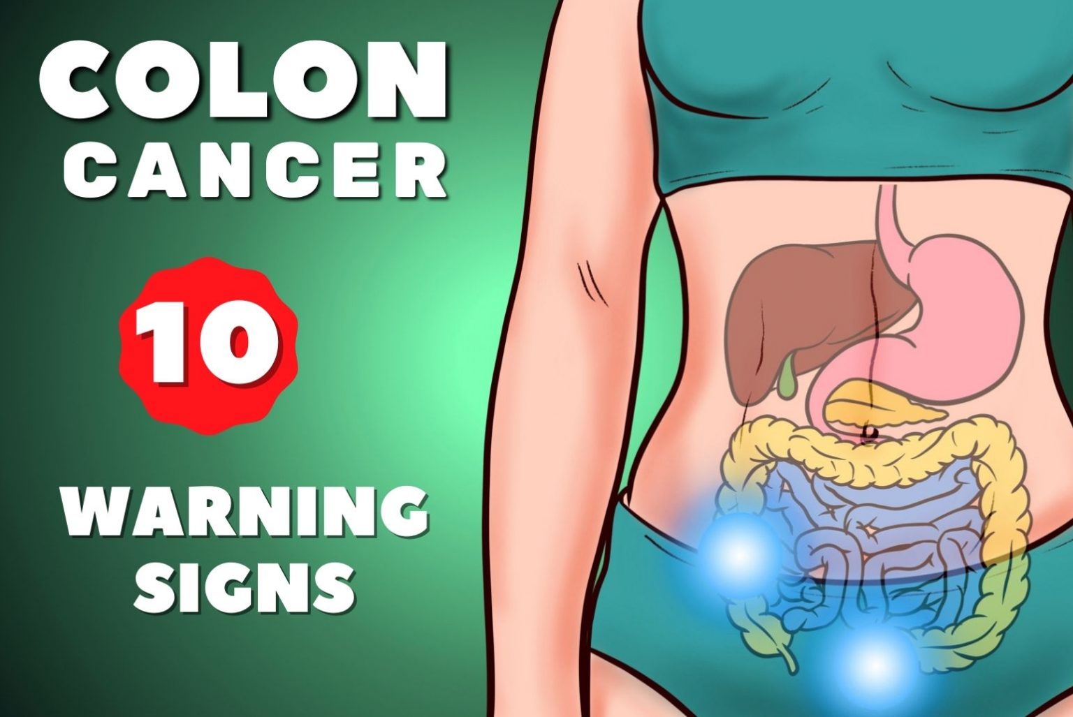 Colon Cancer Symptoms and Warning Signs - Medinaz Blog