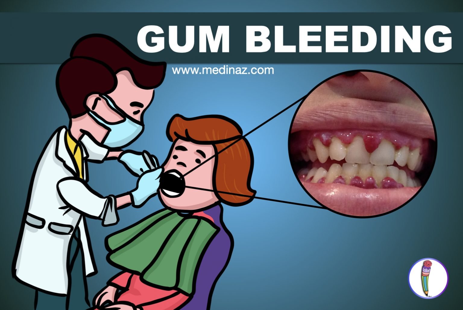 Gum Bleeding causes & Tips to Prevent Medinaz Blog