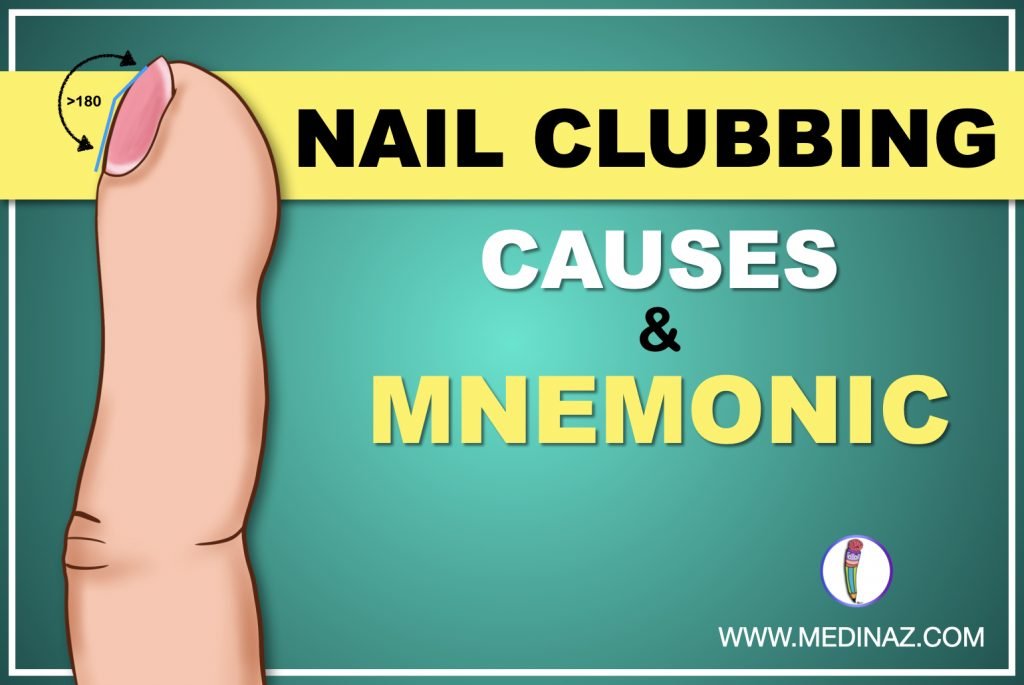 Nail Clubbing Causes & Mnemonic to Remember Medinaz Blog