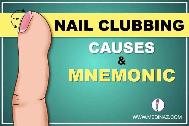 Nail clubbing causes
