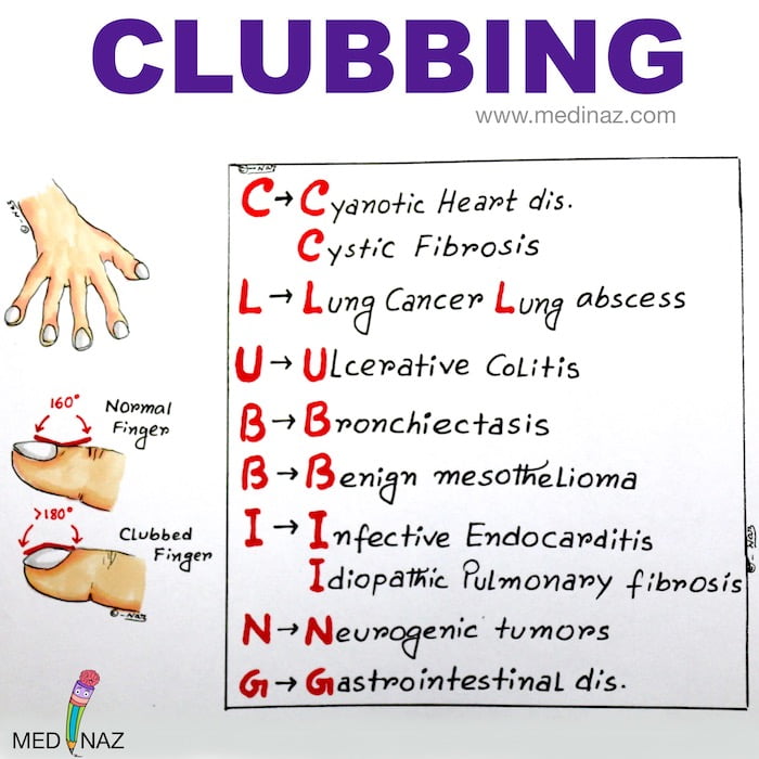 Nail clubbing mnemonic