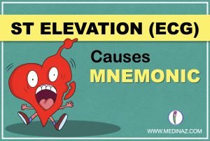 ST segment elevation mnemonic (ECG) - Medinaz Blog