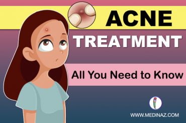 The image contains a young girl with acne face with title of Acne Treatment