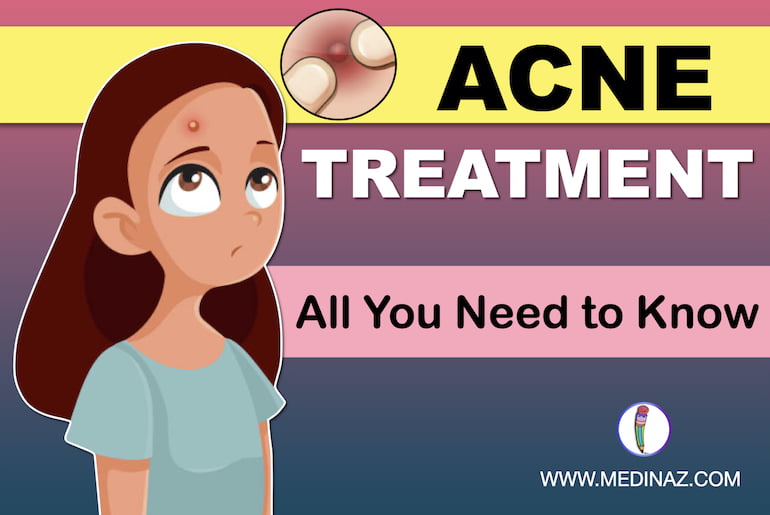 The image contains a young girl with acne face with title of Acne Treatment