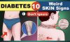 Skin conditions from diabetes – Don’t ignore