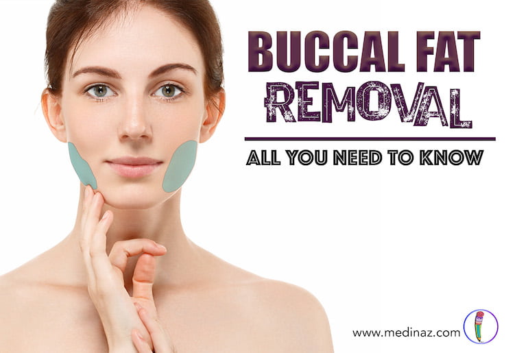 Buccal Fat removal
