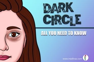 Dark circle under eyes
