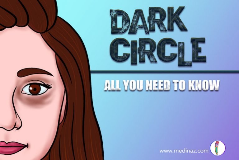 Dark circle under eyes All You Need to Know