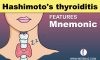 Hashimoto’s thyroiditis Mnemonic