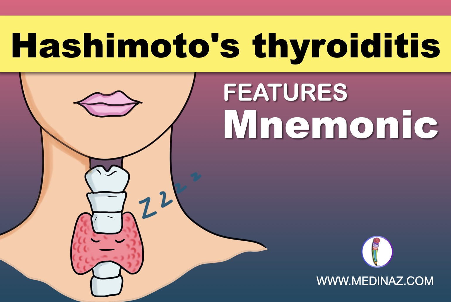 The image contains thyroid gland and write up Hashimoto's thyroiditis Mnemonic
