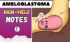 Ameloblastoma: High-yield Dental Notes