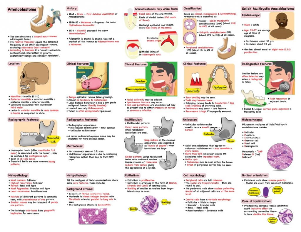 ANGLE'S CLASSIFICATION MALOCCLUSION - Dental Notes