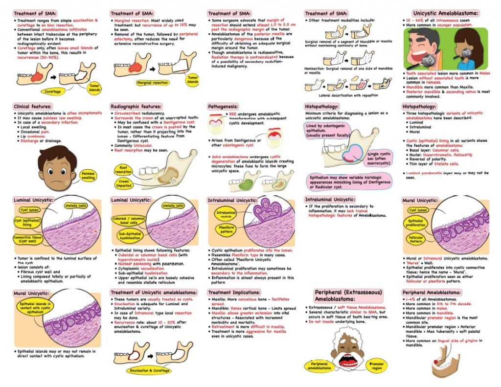 Ameloblastoma Notes 2