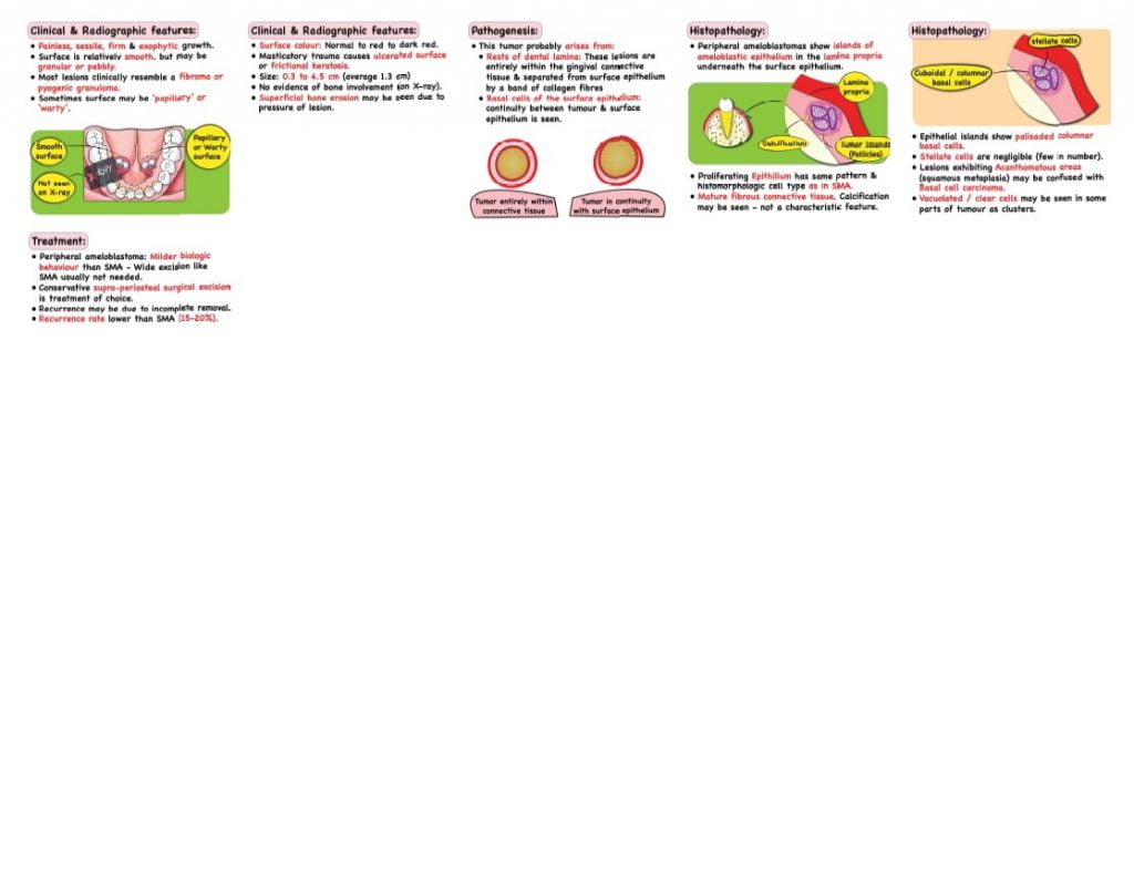 Ameloblastoma Notes 4