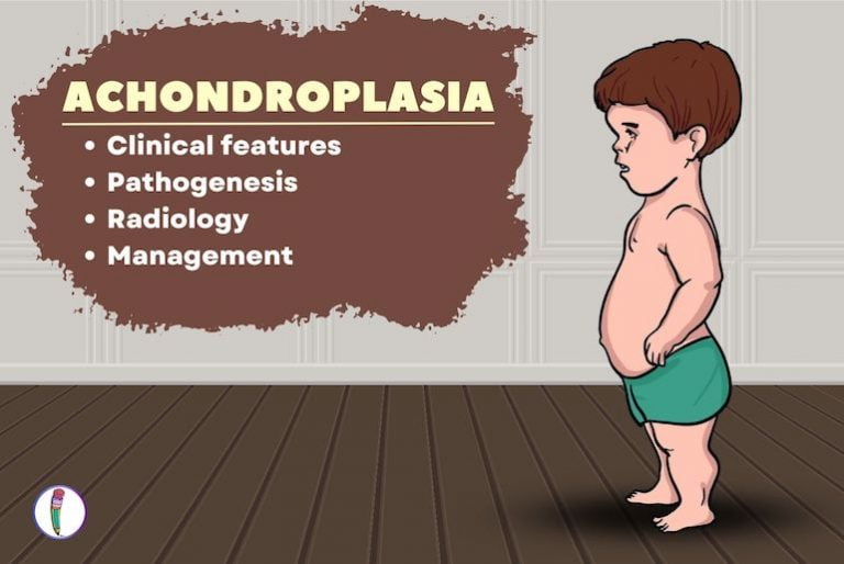 Achondroplasia Medicine Notes