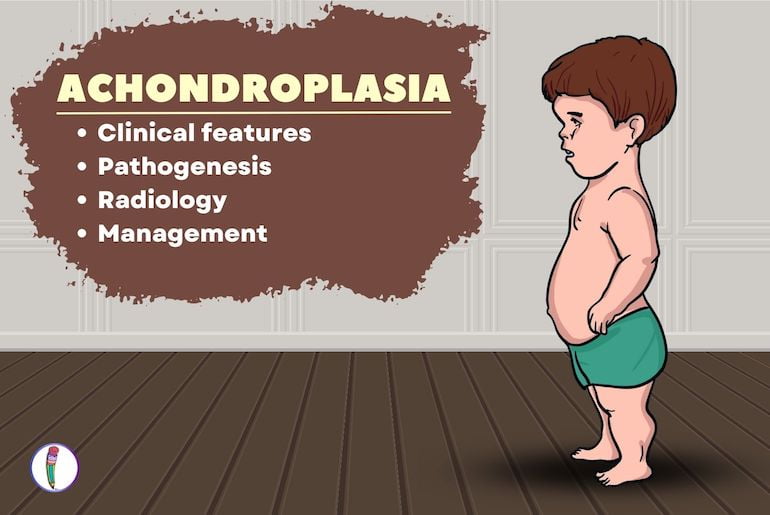 Achondroplasia Medical Notes