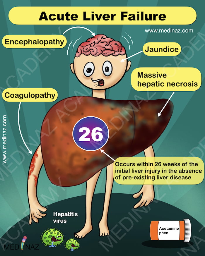 Acute Liver Failure Pathology: HY Note