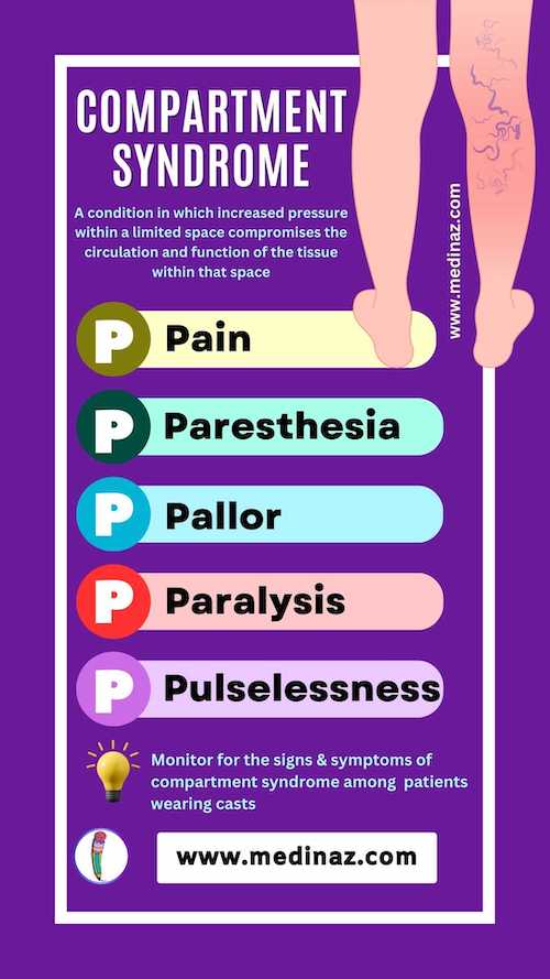 Compartment Syndrome 5P