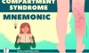 Compartment Syndrome 5p | Compartment Syndrome Mnemonic