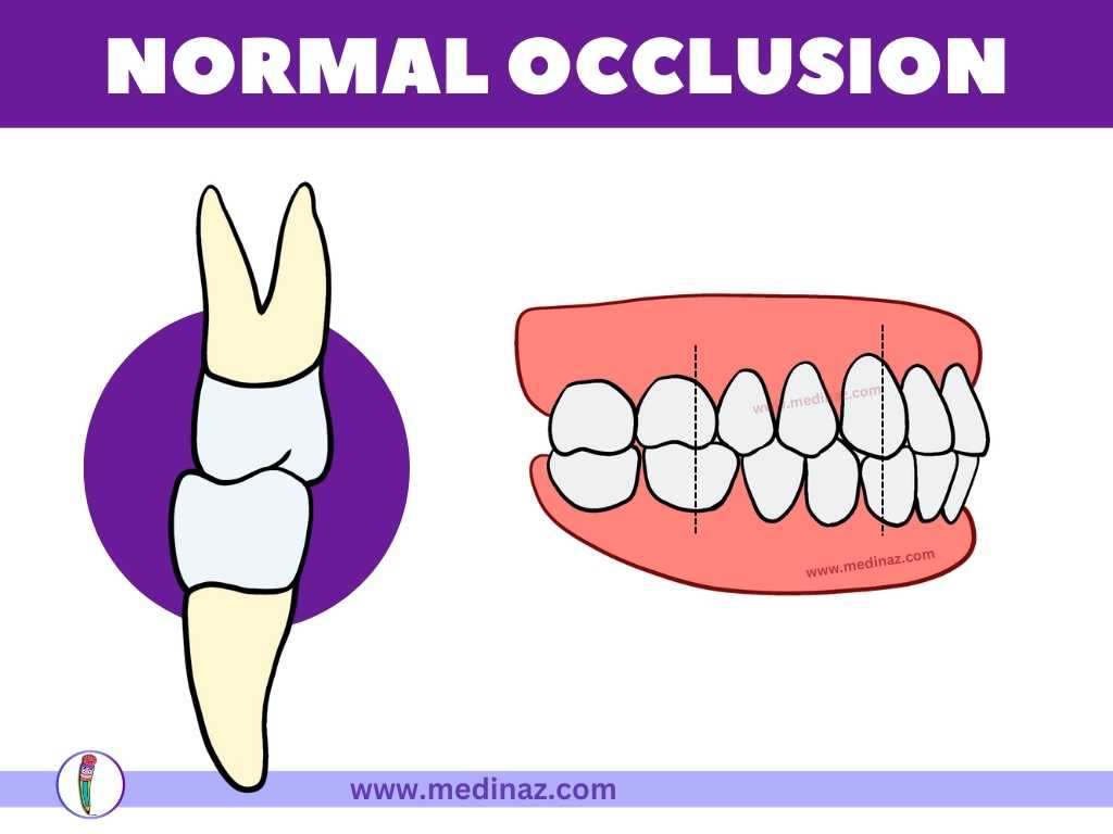 Normal Occlusion