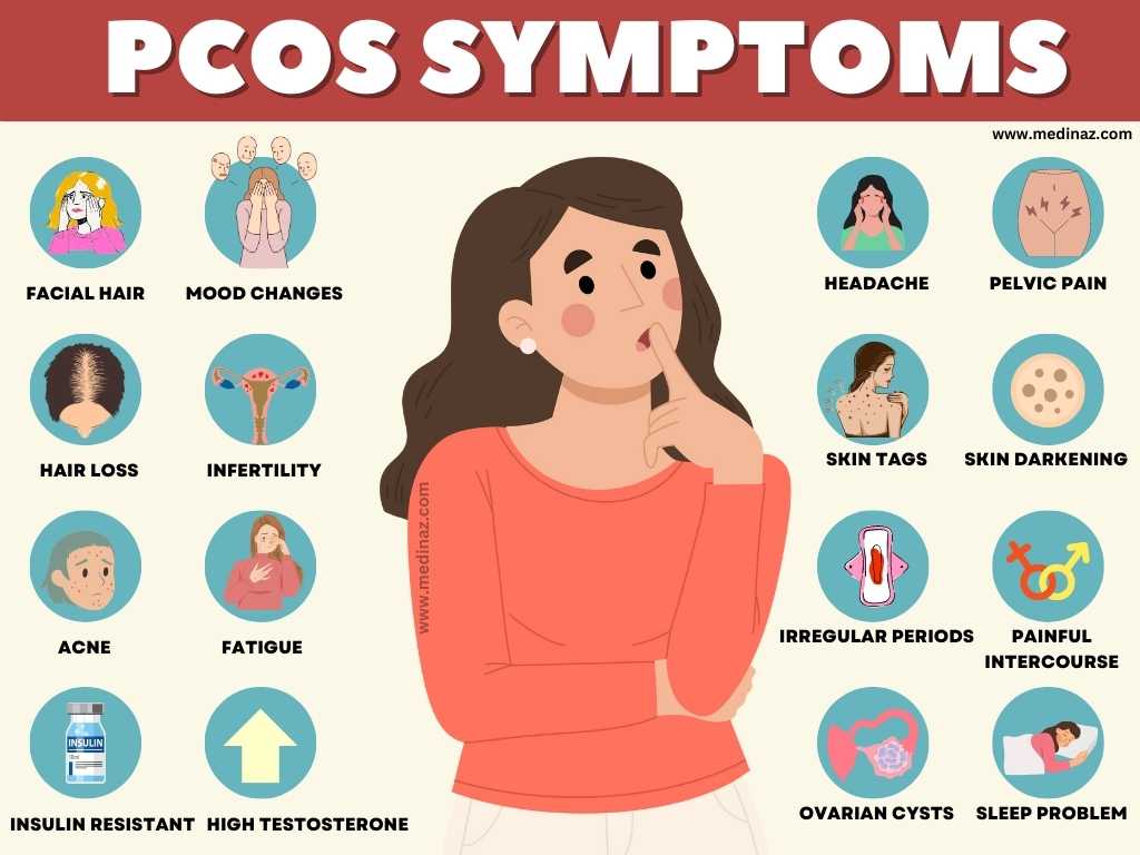 PCOS SYMPTOMS
