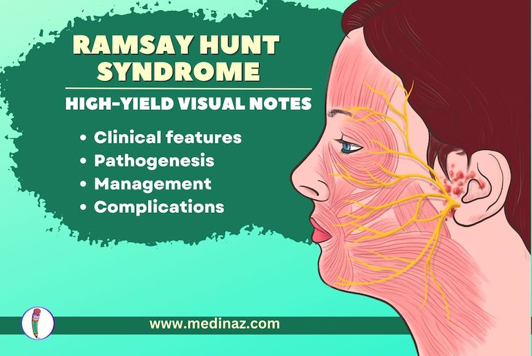 Ramsay Hunt Syndrome - High-yield Medicine Notes