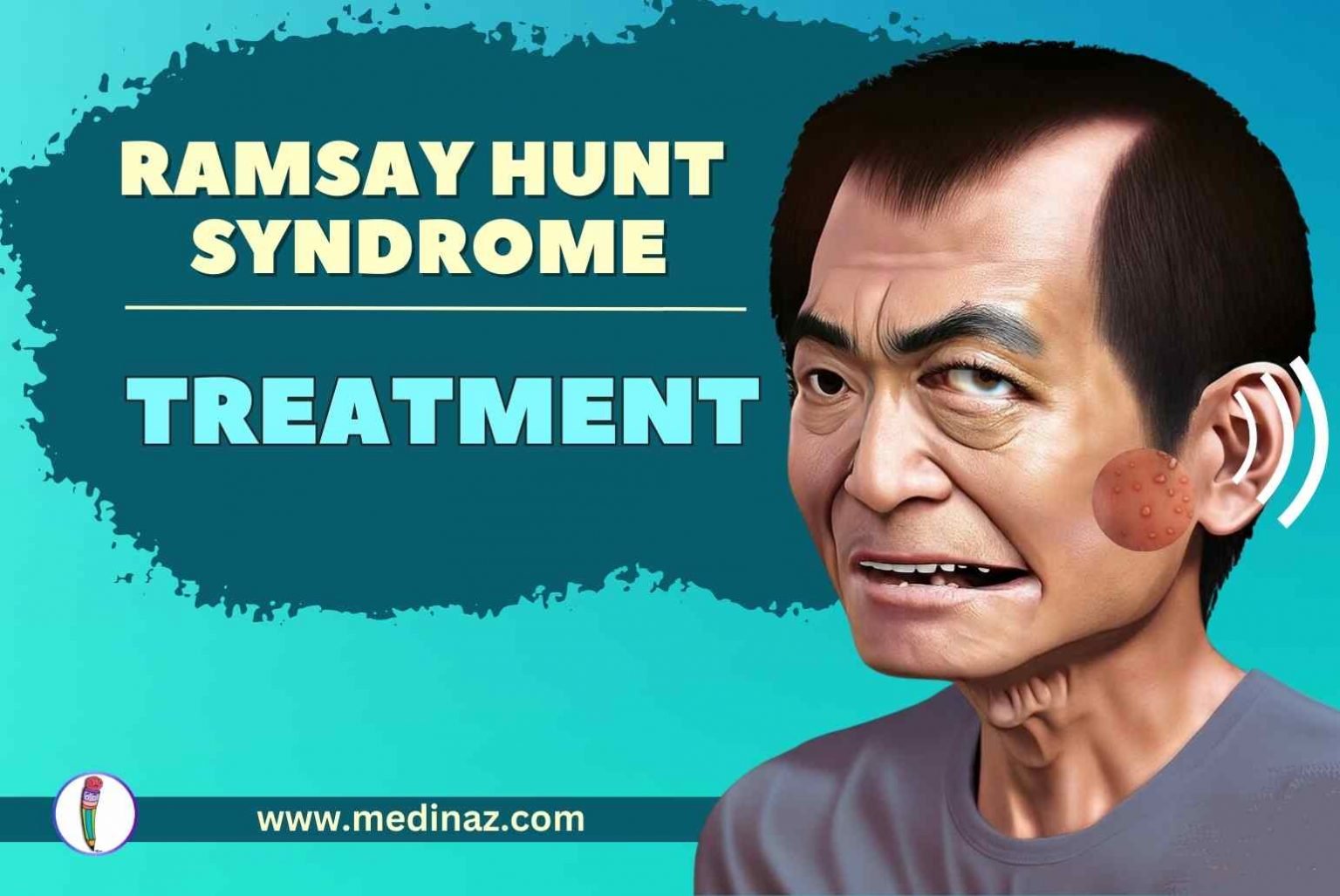 Ramsay Hunt Syndrome Treatment Medinaz Blog 3737