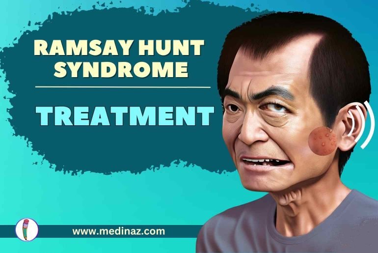 Ramsay Hunt Syndrome Treatment