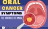 Oral Cancer Symptoms – All You Need to Know