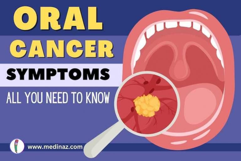 Oral Cancer Symptoms - All You Need to Know