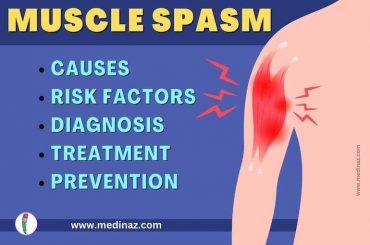 Understanding Muscle Spasms: Causes, Symptoms, Treatment