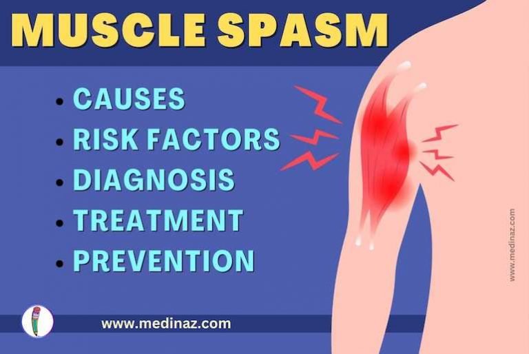 Muscle Spasms The Ultimate Guide
