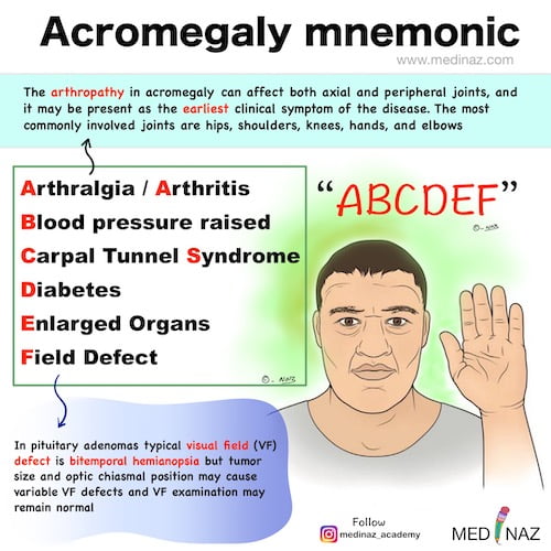 Acromegaly mnemonic