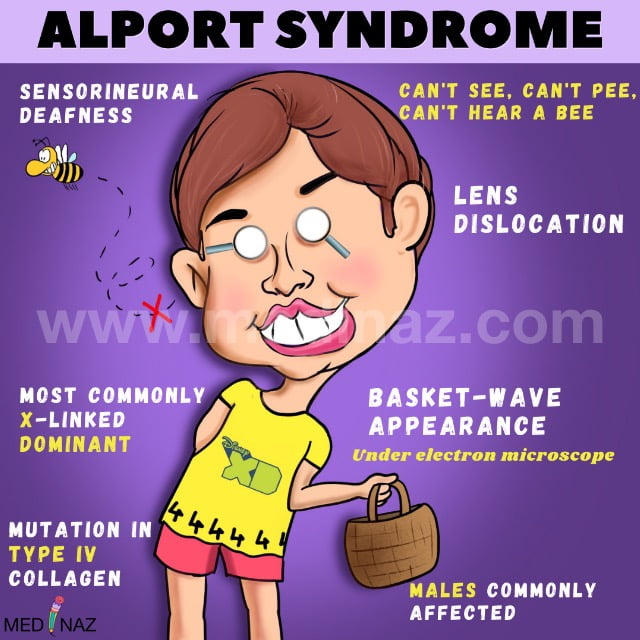 Alport syndrome mnemonic