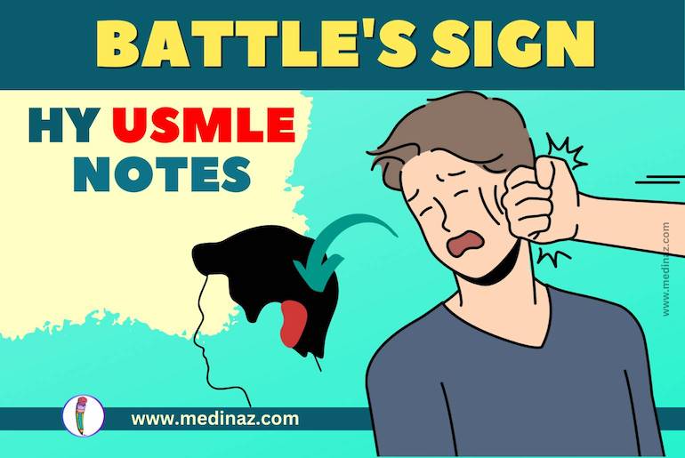 Battle's Sign USMLE