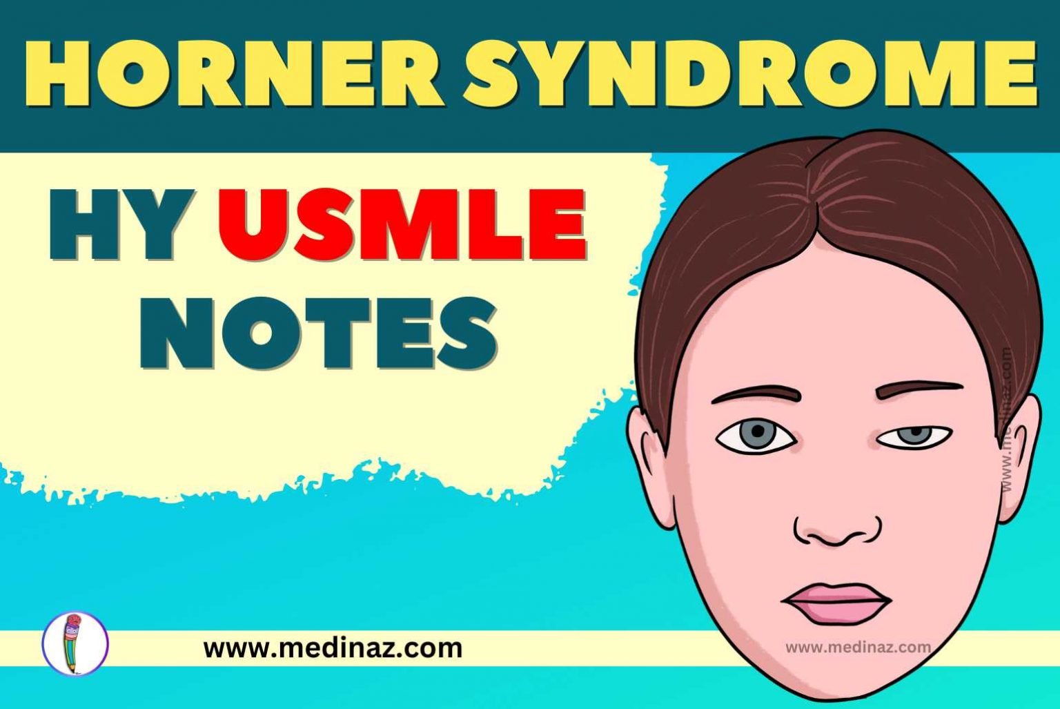 Horner Syndrome Usmle Notes