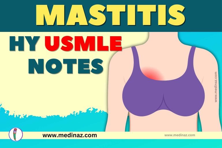 Mastitis USMLE Notes