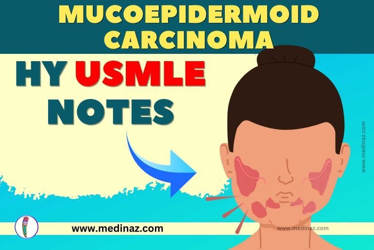 Mucoepidermoid Carcinoma USMLE Notes