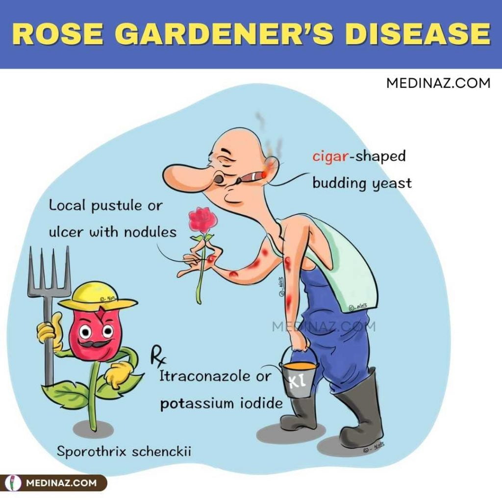 ROSE GARDENER’S DISEASE